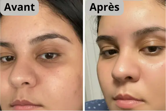 Patch anti cernes Image